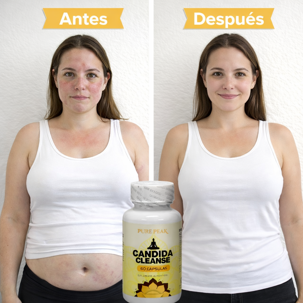 Candida Cleanse® - Menos hinchazón, menos gases y más energía en tus primeras semanas (sin químicos).